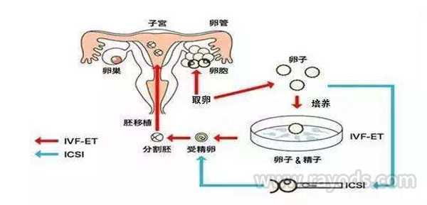 泰国辅助生殖技术有哪些?第一代，第二代，第三代试管